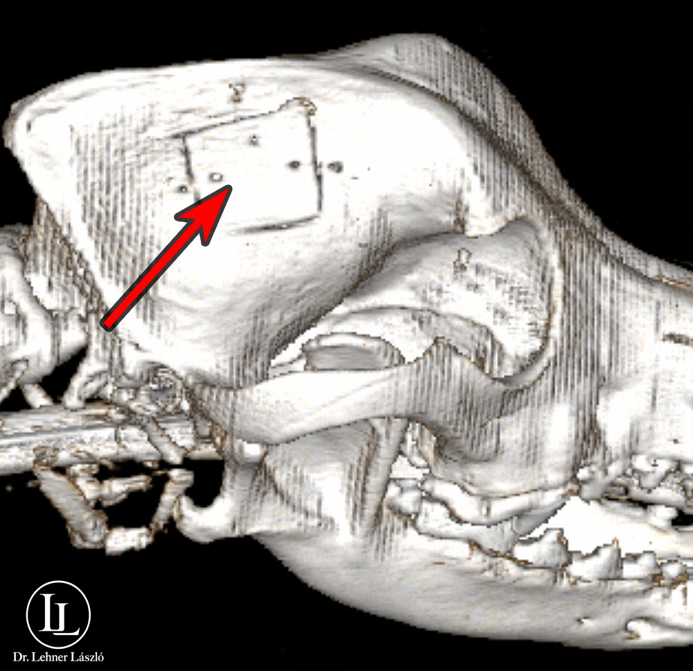 postop 3D CT